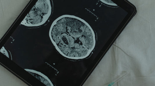 Image of a brain scan