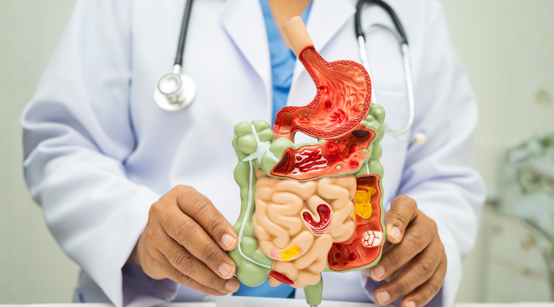 Doctor holding digestive system model illustrating gut health, microbiome function and its impact on metabolism and weight loss